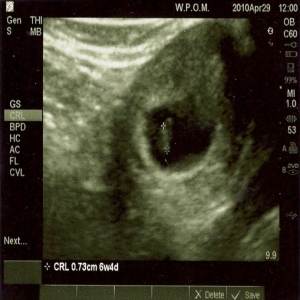6wks4dys